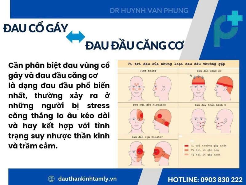 đau đầu căng cơ
