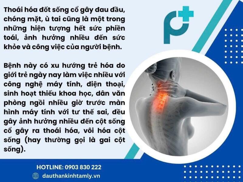 đau đầu căng cơ