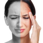 Migraine